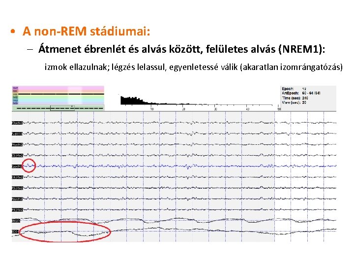  • A non-REM stádiumai: – Átmenet ébrenlét és alvás között, felületes alvás (NREM