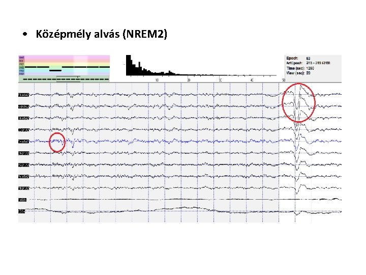  • Középmély alvás (NREM 2) 