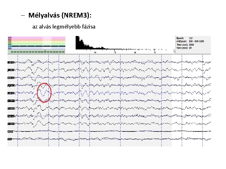 – Mélyalvás (NREM 3): az alvás legmélyebb fázisa 