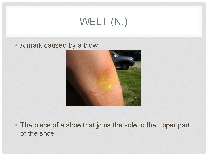 WELT (N. ) • A mark caused by a blow • The piece of