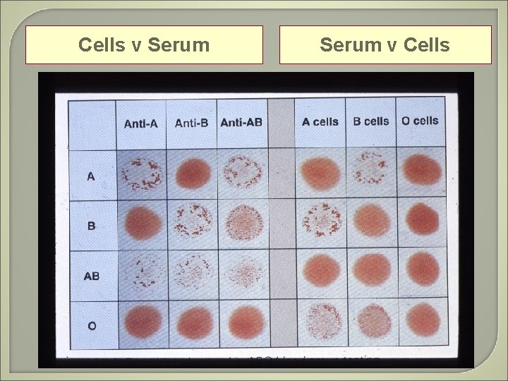 Cells v Serum v Cells 