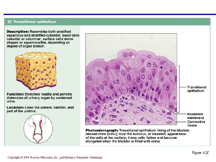 § Several cell layers, basal cells are cuboidal, surface cells are dome shaped §