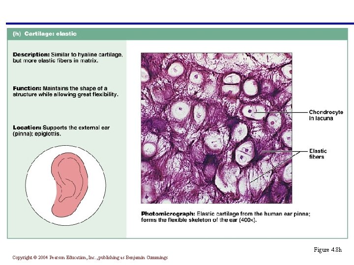 § Similar to hyaline cartilage but with more elastic fibers § Maintains shape and