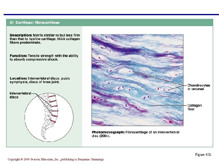 § Matrix similar to hyaline cartilage but less firm with thick collagen fibers §