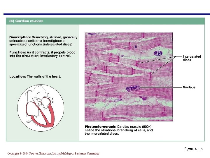 § Branching, striated, uninucleate cells interdigitating at intercalated discs § Propels blood into the