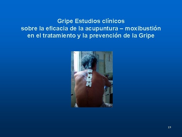 Gripe Estudios clínicos sobre la eficacia de la acupuntura – moxibustión en el tratamiento