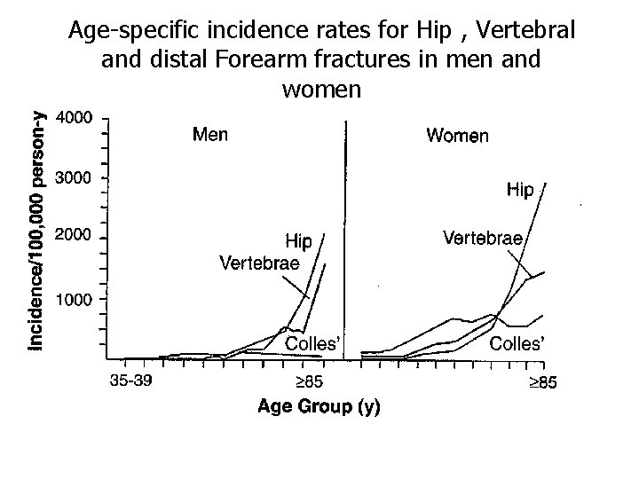 Age-specific incidence rates for Hip , Vertebral and distal Forearm fractures in men and