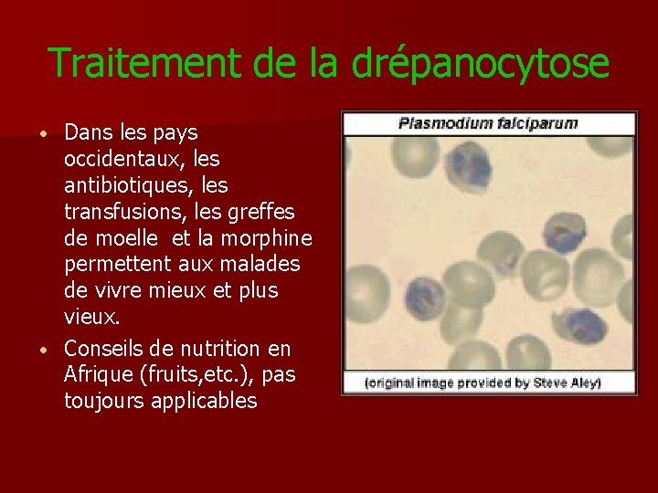 Traitement de la drépanocytose Dans les pays occidentaux, les antibiotiques, les transfusions, les greffes