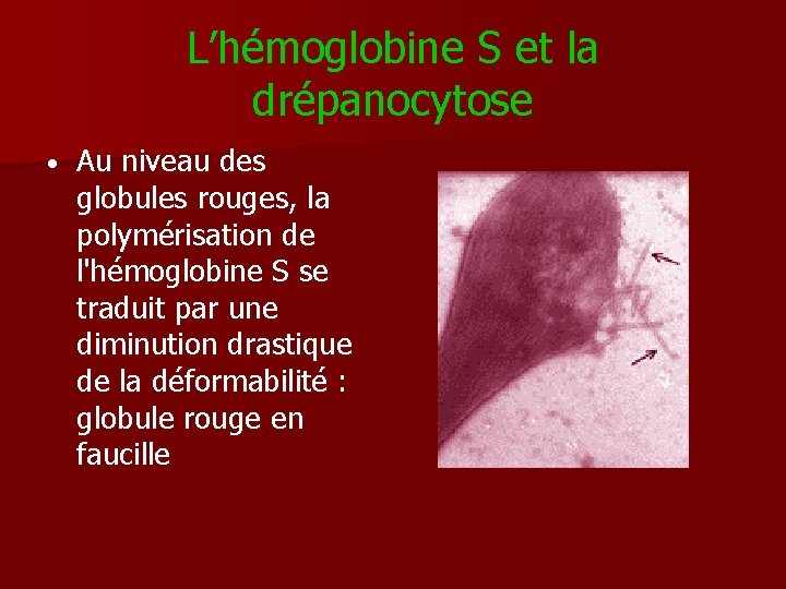 L’hémoglobine S et la drépanocytose • Au niveau des globules rouges, la polymérisation de