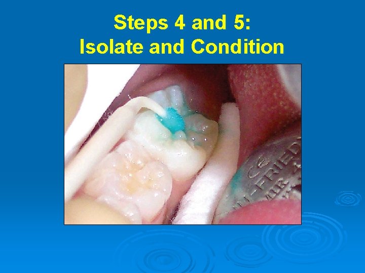 Steps 4 and 5: Isolate and Condition 