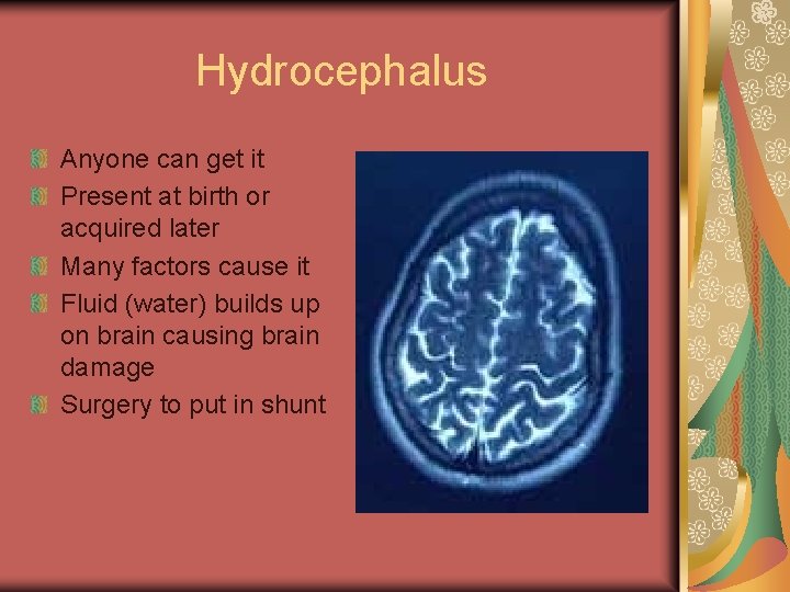 Hydrocephalus Anyone can get it Present at birth or acquired later Many factors cause