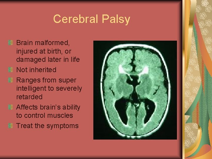 Cerebral Palsy Brain malformed, injured at birth, or damaged later in life Not inherited