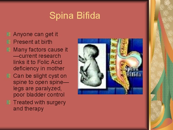 Spina Bifida Anyone can get it Present at birth Many factors cause it —current