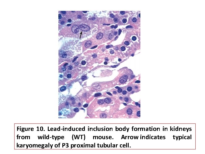 Figure 10. Lead-induced inclusion body formation in kidneys from wild-type (WT) mouse. Arrow indicates