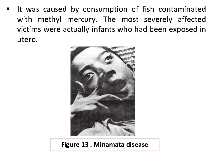 § It was caused by consumption of fish contaminated with methyl mercury. The most