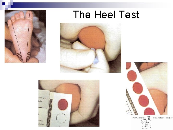The Heel Test 