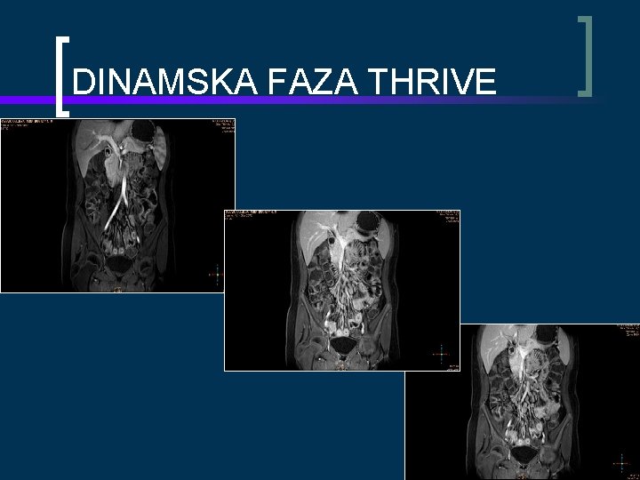 DINAMSKA FAZA THRIVE 