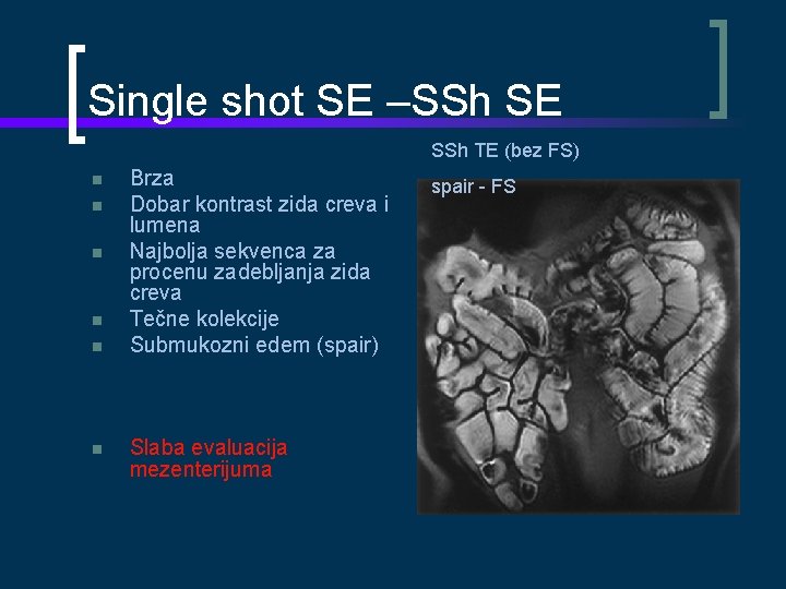 Single shot SE –SSh SE SSh TE (bez FS) Brza Dobar kontrast zida creva