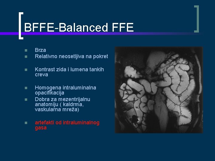 BFFE-Balanced FFE Brza Relativno neosetljiva na pokret Kontrast zida i lumena tankih creva Homogena