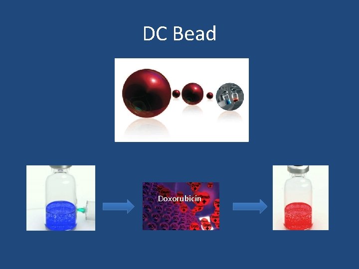 DC Bead Doxorubicin 