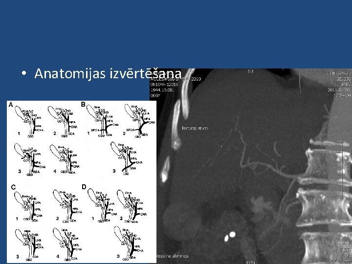  • Anatomijas izvērtēšana 