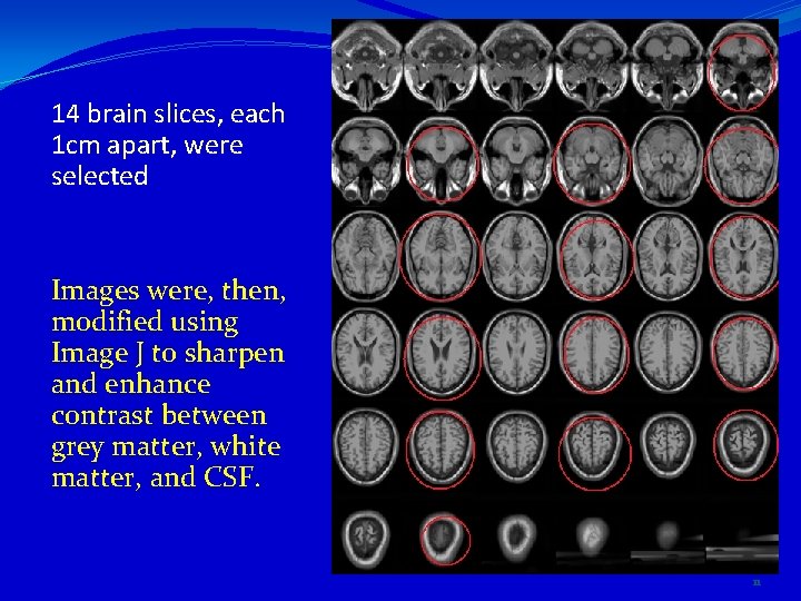 14 brain slices, each 1 cm apart, were selected Images were, then, modified using