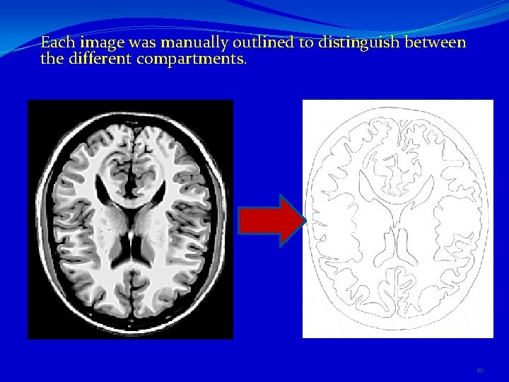 Each image was manually outlined to distinguish between the different compartments. 12 