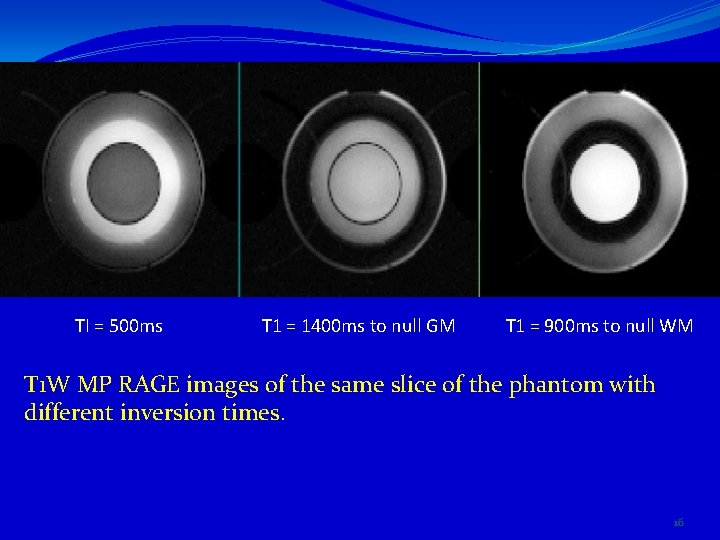 TI = 500 ms T 1 = 1400 ms to null GM T 1