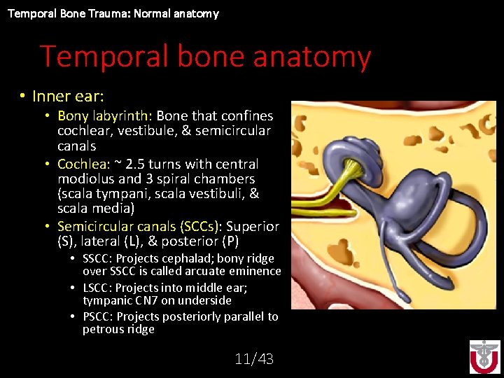 Temporal Bone Trauma: Normal anatomy Temporal bone anatomy • Inner ear: • Bony labyrinth: