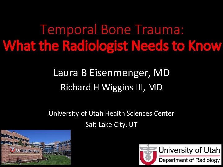 Temporal Bone Trauma: What the Radiologist Needs to Know Laura B Eisenmenger, MD Richard