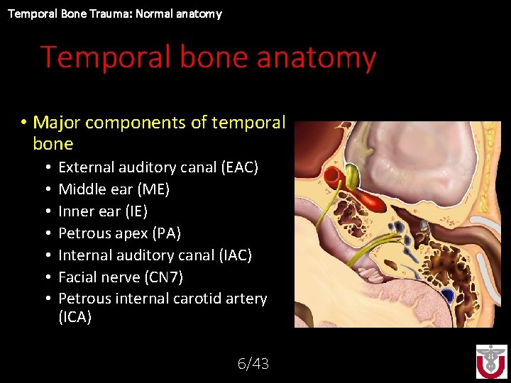 Temporal Bone Trauma: Normal anatomy Temporal bone anatomy • Major components of temporal bone