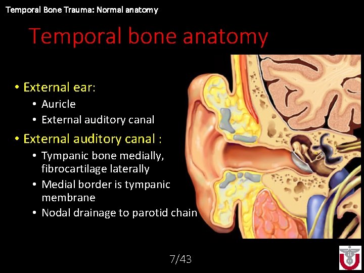 Temporal Bone Trauma: Normal anatomy Temporal bone anatomy • External ear: • Auricle •