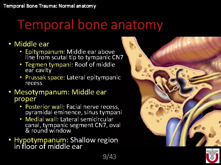 Temporal Bone Trauma: Normal anatomy Temporal bone anatomy • Middle ear • Epitympanum: Middle