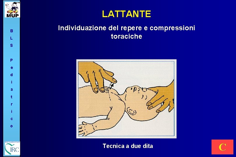 LATTANTE B L Individuazione del repere e compressioni toraciche S P e d i