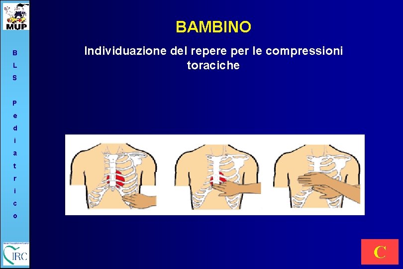 BAMBINO B L Individuazione del repere per le compressioni toraciche S P e d
