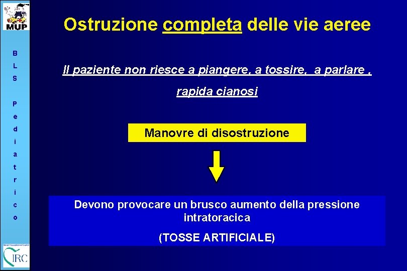 Ostruzione completa delle vie aeree B L S Il paziente non riesce a piangere,