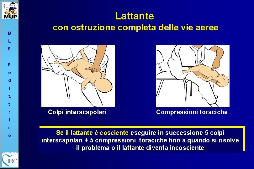 Lattante B con ostruzione completa delle vie aeree L S P e d i