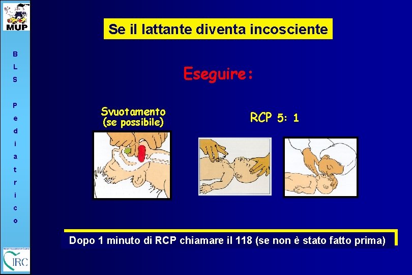 Se il lattante diventa incosciente B Eseguire: L S P e d Svuotamento (se