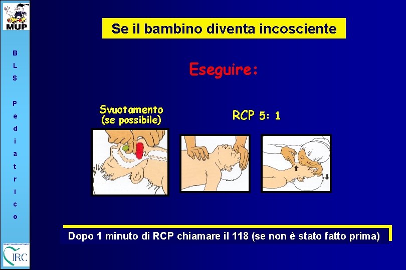 Se il bambino diventa incosciente B Eseguire: L S P e d Svuotamento (se