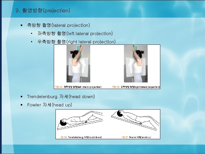 9. 촬영방향(projection) § 측방향 촬영(lateral projection) • 좌측방향 촬영(left lateral projection) • 우측방향 촬영(right