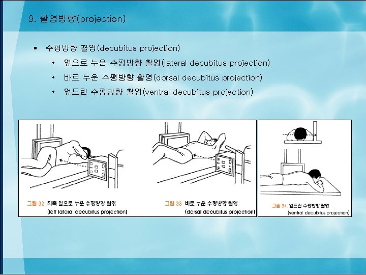 9. 촬영방향(projection) § 수평방향 촬영(decubitus projection) • 옆으로 누운 수평방향 촬영(lateral decubitus projection) •
