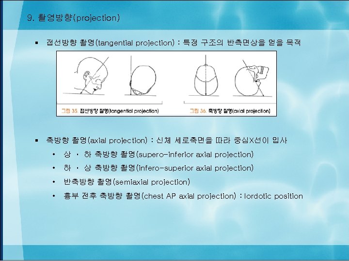 9. 촬영방향(projection) § 접선방향 촬영(tangential projection) : 특정 구조의 반측면상을 얻을 목적 § 축방향