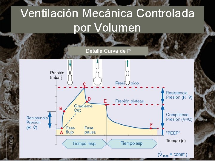 Ventilación Mecánica Controlada por Volumen Detalle Curva de P 