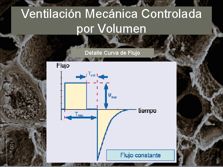 Ventilación Mecánica Controlada por Volumen Detalle Curva de Flujo 
