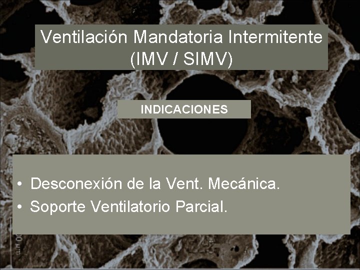 Ventilación Mandatoria Intermitente (IMV / SIMV) INDICACIONES • Desconexión de la Vent. Mecánica. •