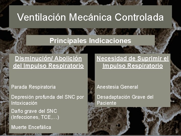Ventilación Mecánica Controlada Principales Indicaciones Disminución/ Abolición del Impulso Respiratorio Necesidad de Suprimir el