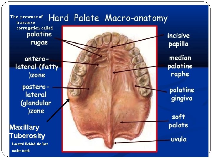 The presence of trasverse corrugation called Maxillary Tuberosity Located Behind the last molar tooth