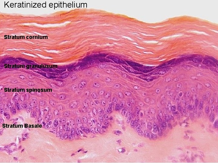 Keratinized epithelium Stratum cornium Stratum granulusum Stratum spinosum Stratum Basale 