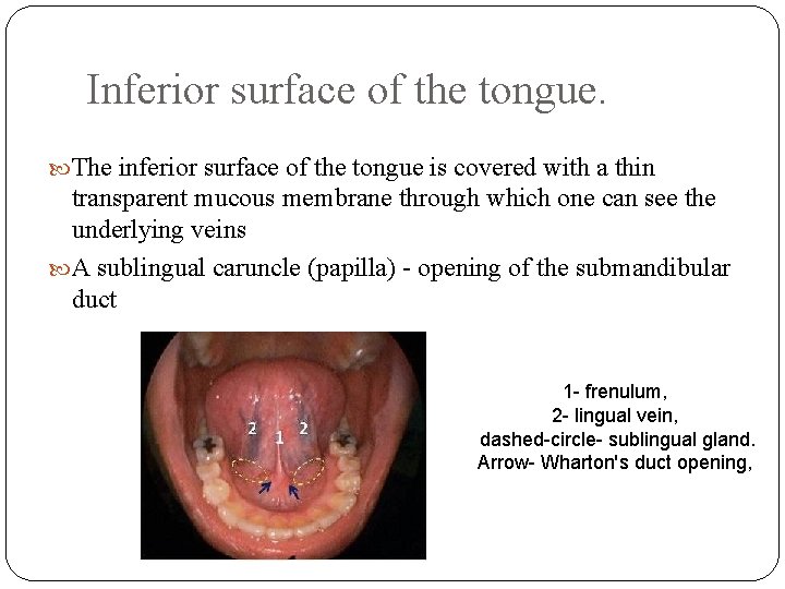 Inferior surface of the tongue. The inferior surface of the tongue is covered with
