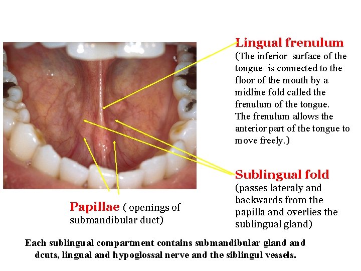 Lingual frenulum (The inferior surface of the tongue is connected to the floor of